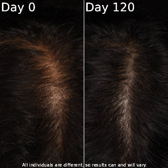 Comparison of hair texture between 'Day 0' and 'Day 120' on a dark background.