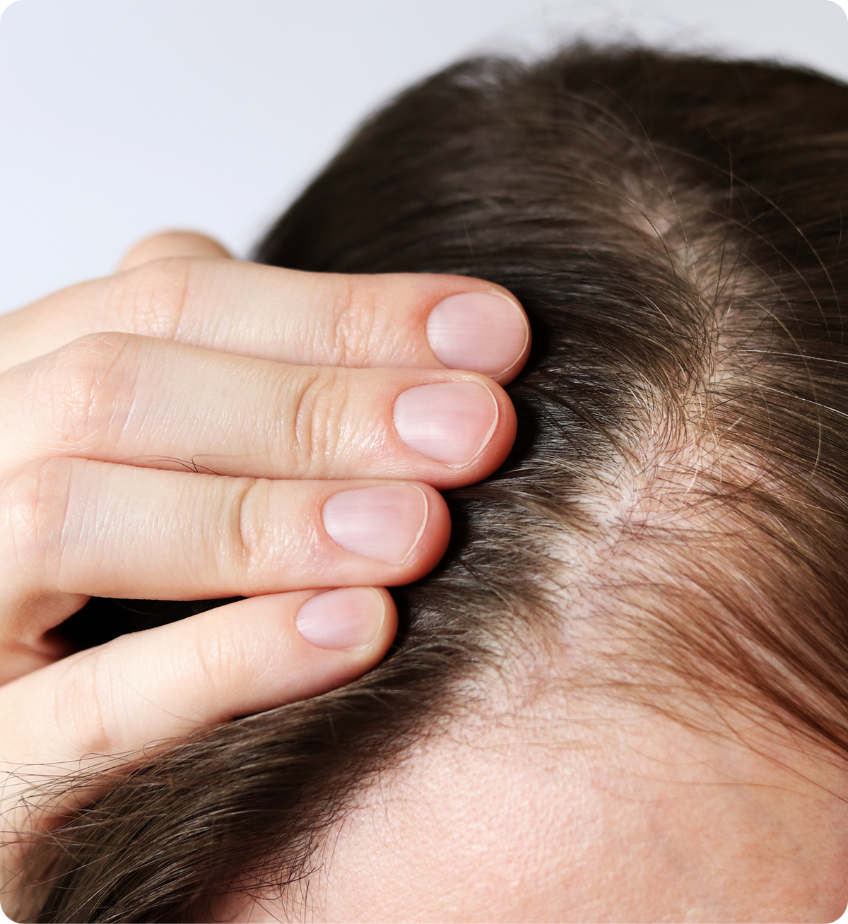 Person parting hair to reveal thinning scalp and a widened center part