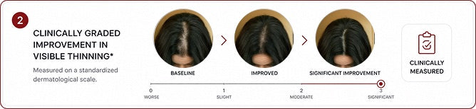 Clinically graded improvement in visible thinning from baseline to significant improvement on a standardized dermatological scale