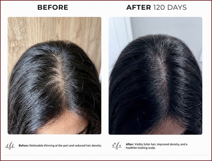 Before and after comparison showing fuller hair and improved density after 120 days