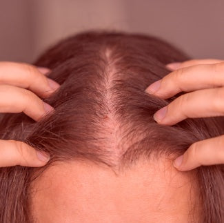 Close-up of a scalp with hair parted by hands, showing visible thinning along the center part