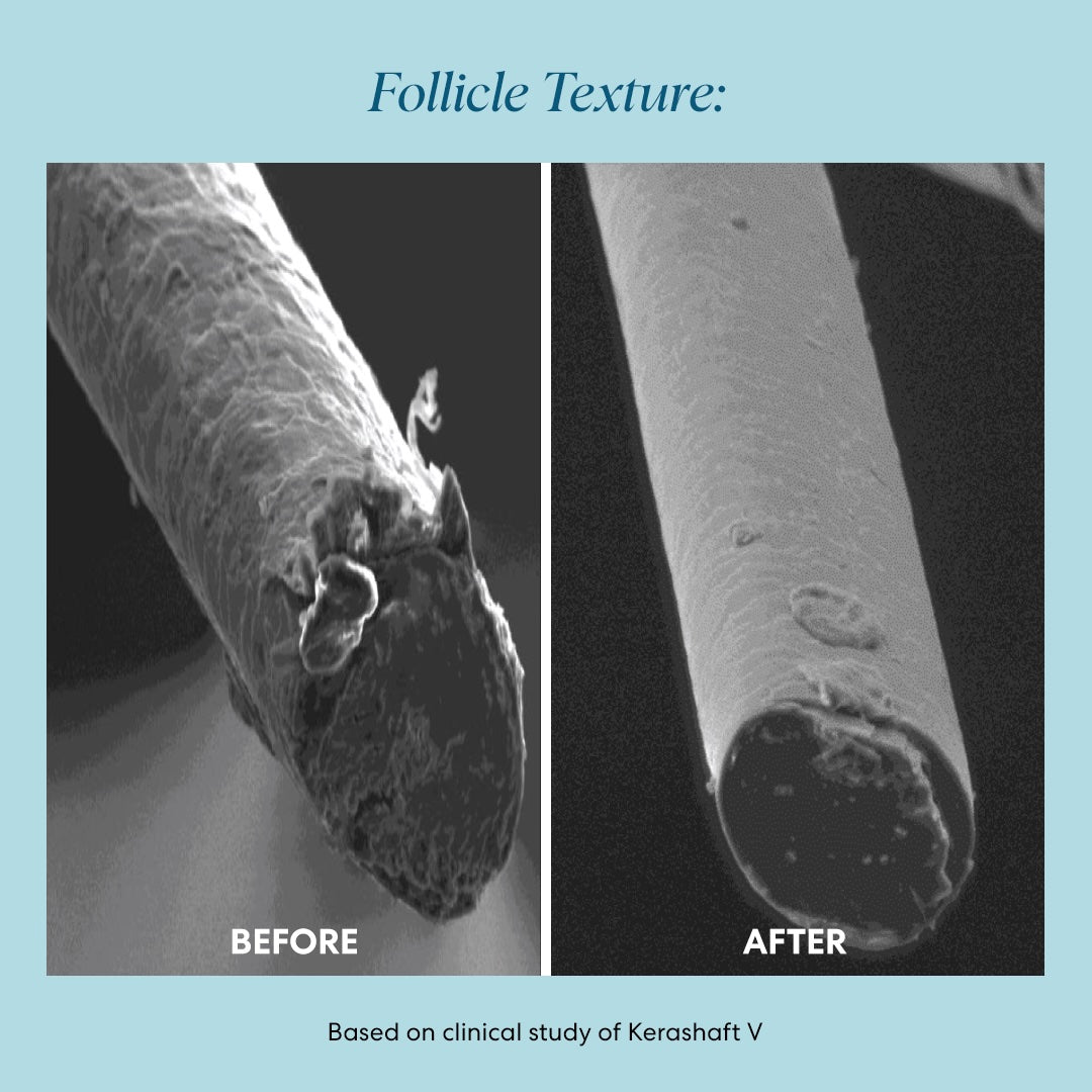 Follicle Texture: side-by-side microscope images showing a frayed, damaged hair shaft before and a smoother, sealed hair shaft after treatment