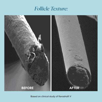 Follicle Texture: side-by-side microscope images showing a frayed, damaged hair shaft before and a smoother, sealed hair shaft after treatment