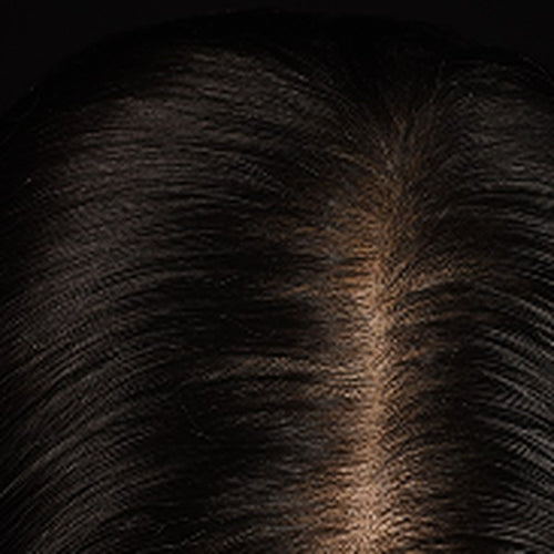 Week 2 progress photo showing a close-up scalp part with dark hair