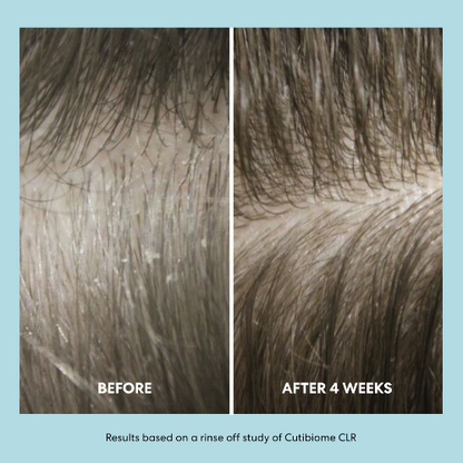Before and after comparison of hair treatment with 'Before' showing dry, brittle hair and 'After 4 Weeks' showing improved hair health.